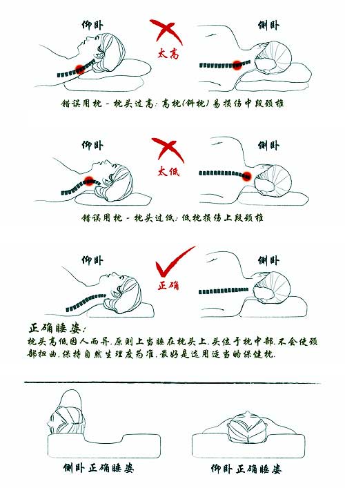 失眠腹胀烦躁 可能是颈椎病