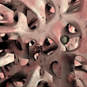 与关节炎 类风湿性关节炎有别 只有骨质疏松症会骨折