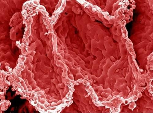 重大突破 可提早6年发现癌症