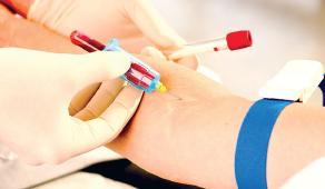 女人更年期 验血可推知