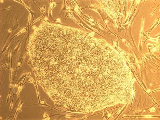 美准胚胎干细胞医瘫痪病人