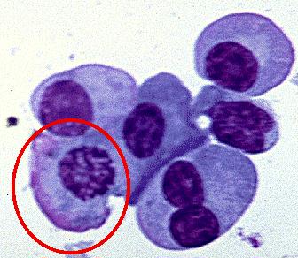 以色列研发“电子鼻” 通过呼吸测查癌症