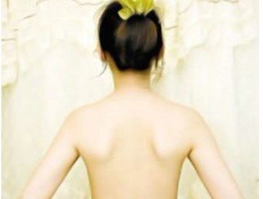 夏季痘痘爆发爆在背部？9妙招让你亮背重现